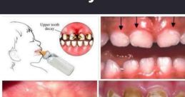 My mouth tastes like teeth