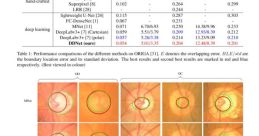 Performance comparison of OD and OC segmentation methods, highlighting DDNet's accuracy on the ORIGA dataset.