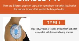 Slap hurt