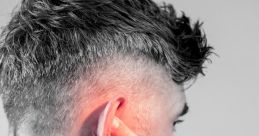 Tinnitus