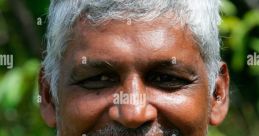 Guyana (Guyana) Male 53yo