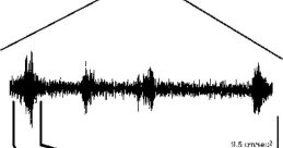 Stridulations