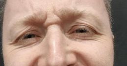 Limmy (Brian Limond) V2