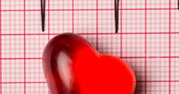 Ekg Ekg