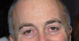 Tony Robinson