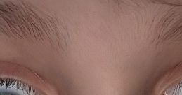 Close-up of a child's eyes, showcasing unique irises with contrasting colors, highlighting individual characteristics.