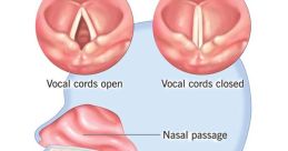 Require a Distinct Vocalization? the Odds Are in Favor of My Possessing It