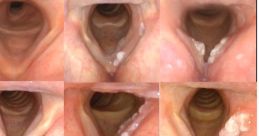 Boundless Vocal Articulations Extending As Far As One's Fancy Ventures