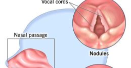 My Vocal Prowess Is at Your Beck and Call Type your text to hear it in the My Vocal Prowess Is at Your Beck and Call . My