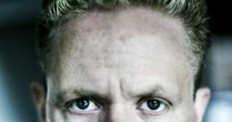 Anders Matthesen