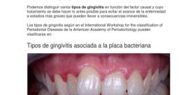 Gingivitis