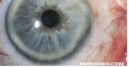 My Eyes
