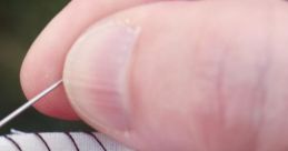 Stitches