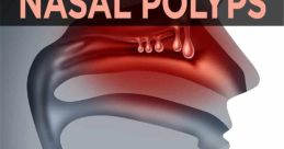 Nasal