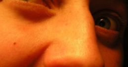Scarry