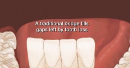 Dental