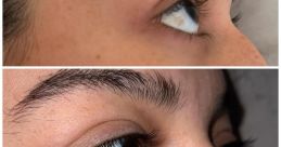 My Eye