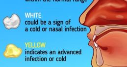 Snot