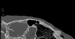 Lion Scan The first that fills the air is a low, rumbling growl that sends shivers down your spine. It is filled with power