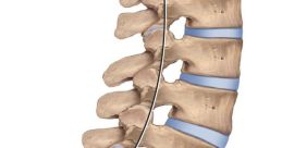 Spine