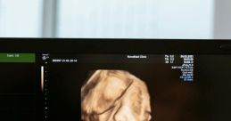 Scanning