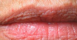 Lips