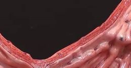 Stomach