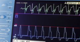 Telemetry