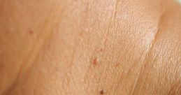 Skin tab