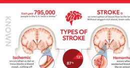 Strokes