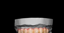 Dental