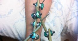 Ankle