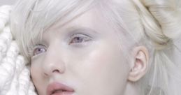 Albino