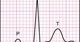 Ecg