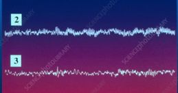 Brain waves Library
