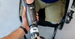 Prosthetic Library