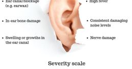 Hearing defect Library