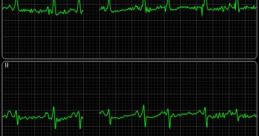 Ekg Library