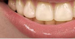 Teeth