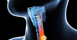 Throat Throat clearing - The of me clearing my throat. I'm bored or annoyed or something. Trying to get attention. The