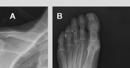 Rickets Man 2