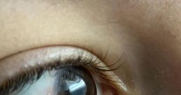 Red eyes