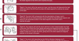 Aivs