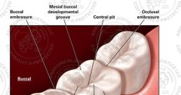 Mesial