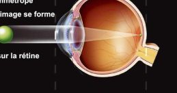 Myeopiez