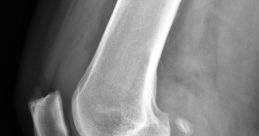 MYrodilla