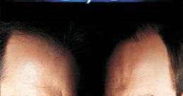 Face Off