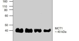 MCT1