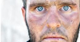 THOUSAND YARD STARE!!!