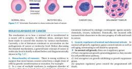Mohen cancer